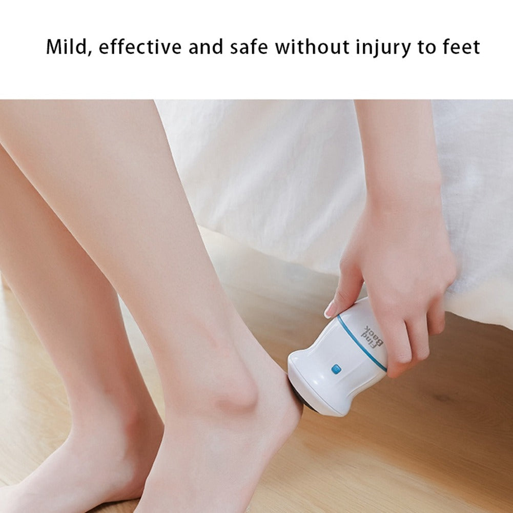 Electric Back Callus Remover with Built-In Vacuum – Rechargeable Foot Grinder for Dead Skin, Cracked Heels & Calluses